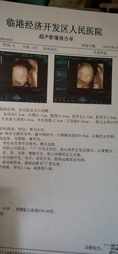 怀孕六个月做四维晚吗