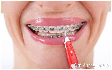 牙齿矫正脸凹陷