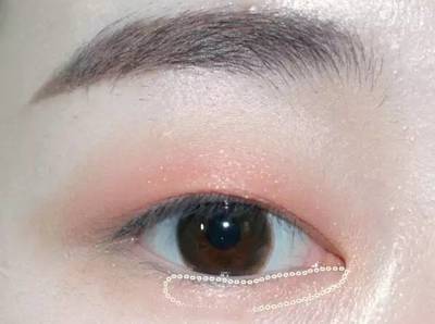 单眼皮有卧蚕吗