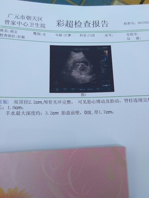 怀孕三个月怎么看男女