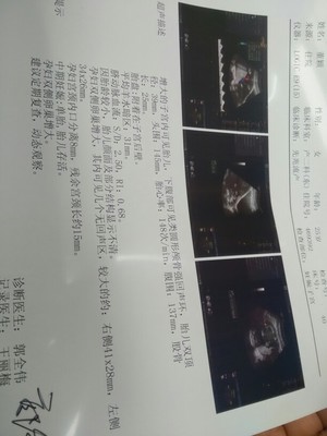 怀孕十七周有胎动吗