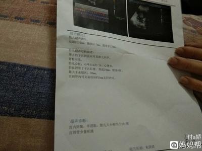 宫颈管积液影响怀孕吗