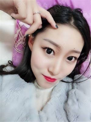 隆鼻可以侧身睡觉吗