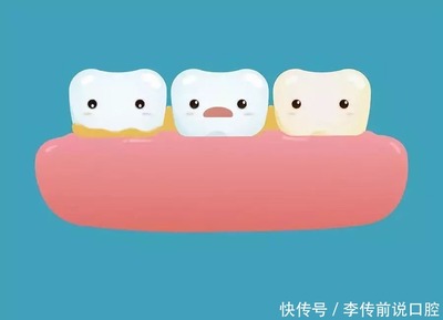 孕妇牙周炎