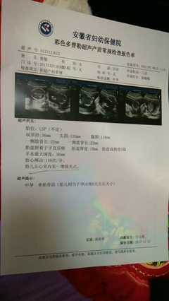 18周胎儿真实图