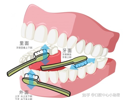 口腔出血是什么原因