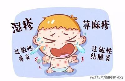 一岁宝宝结膜炎