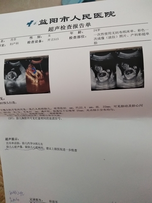 怀孕18周胎儿稳定了吗