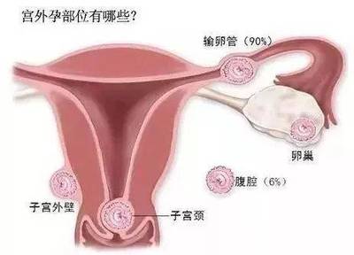 正常怀孕精子最少要达到多少