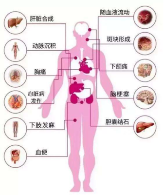 胆固醇高是怎么回事