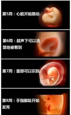 胎儿发育畸形