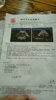 胎儿照片大全集32周