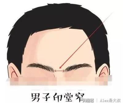 额头两侧发黑是怎么回事
