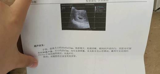 怀孕多久有心管搏动