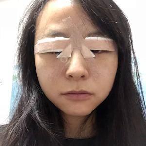天津眼睛修复手术费用多少
