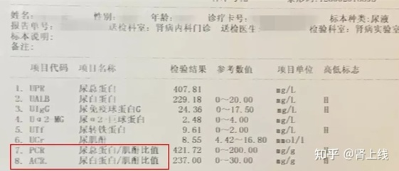 24小时尿蛋白2.43g高多少