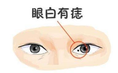 白眼珠多的人什么命
