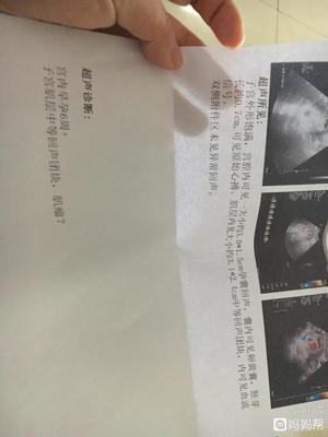 过几天能查出是否怀孕