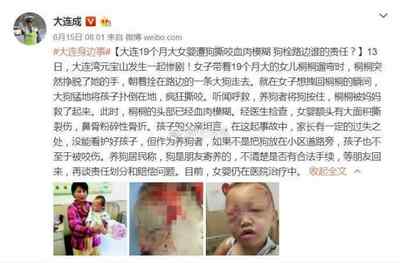 鼻骨骨折赔偿
