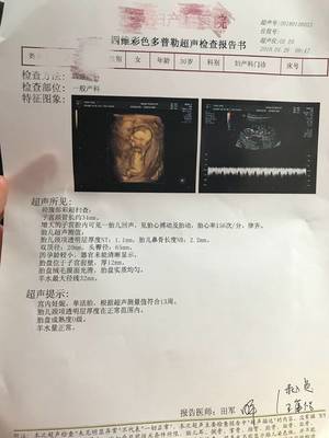 怀孕10周图片