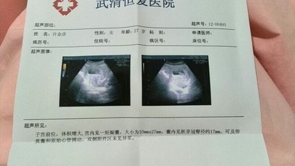 怎么才能确定是否怀孕