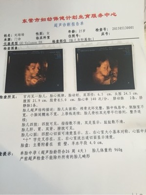 怀孕35天怀男孩症状
