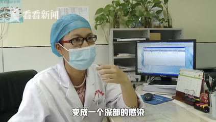 南宁看痘痘喝中药