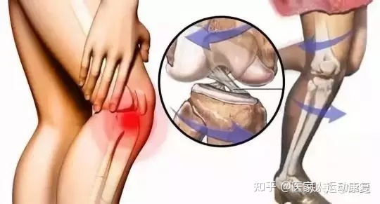 膝盖关节响是怎么回事