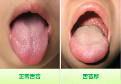 舌苔发绿是怎么回事