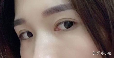 割双眼皮哭了怎么办