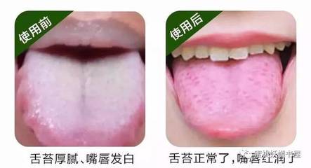 舌苔没了是怎么回事