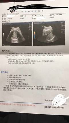孕35周几个月