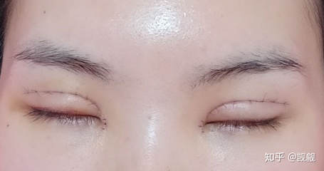 割双眼皮哭了怎么办