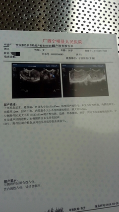 人民医院宫外孕多少钱