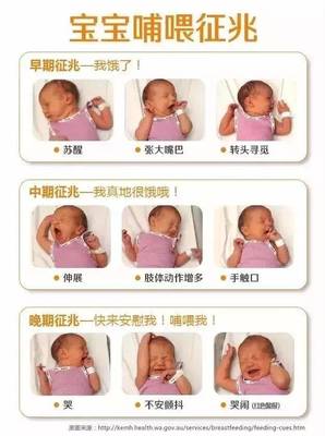新生儿胃图片