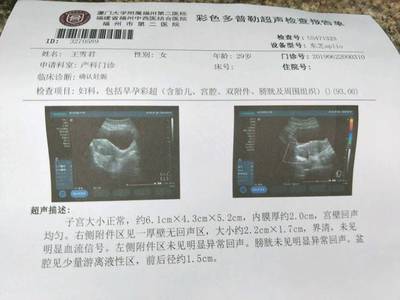 怀孕多久可以验血确认