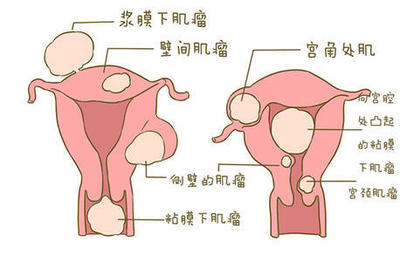 不是排卵期出血是怎么回事