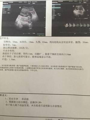 抽血化验怀孕要空腹吗