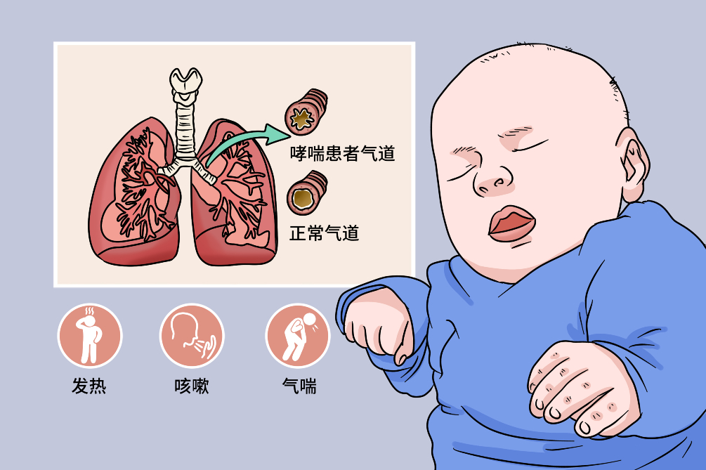 支气管炎哮喘怎么治疗才能除根