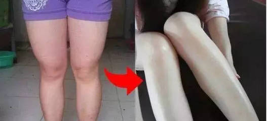 踮脚可以瘦腿吗