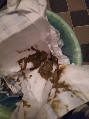 拉黑色粑粑是怎么回事