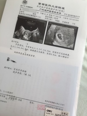 怀孕十七周有胎动吗