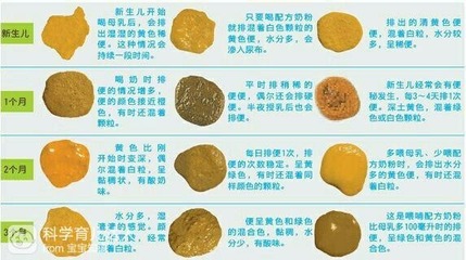 宝宝便便颜色