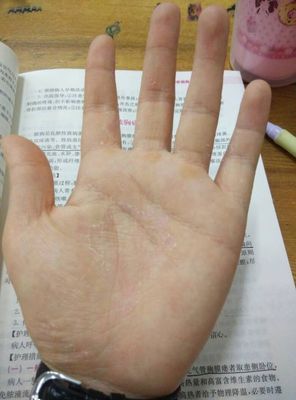 什么食物治痘痘的