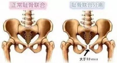 女生大腿根部间距多少最好看