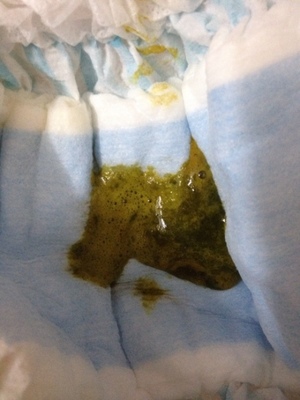 宝宝拉粑粑绿色