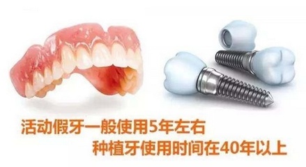 牙齿种牙