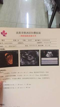 沈阳市妇婴4维排畸多少钱