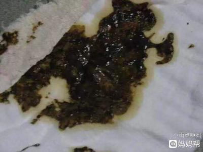 一岁宝宝拉黑色大便怎么回事