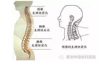 腰椎响是怎么回事